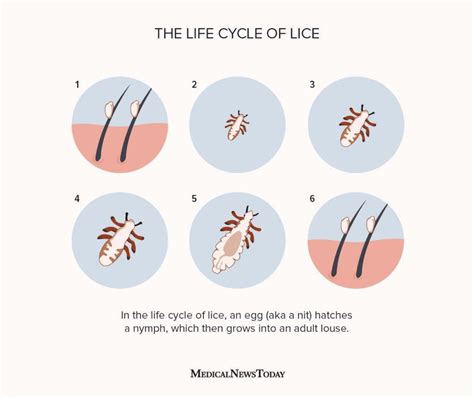 artemide lice|Life cycle of lice: Stages, how they spread, and more .